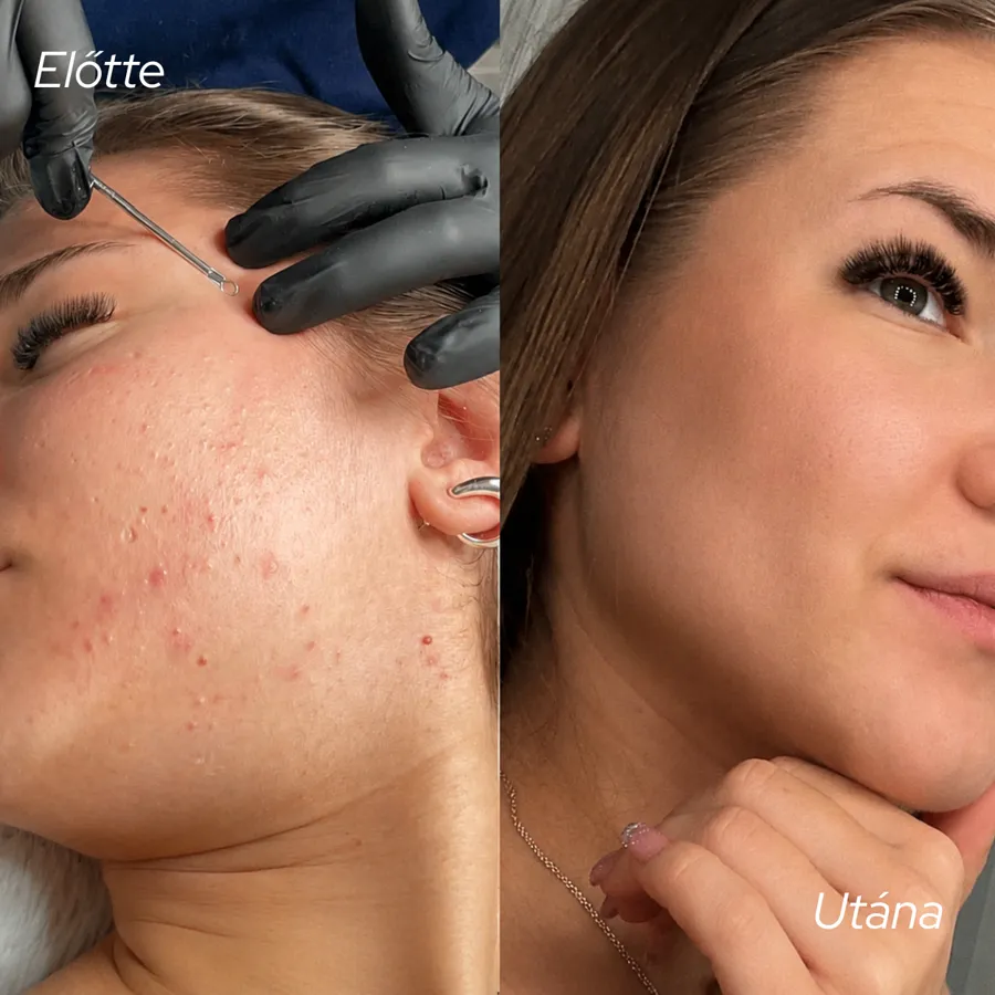 Előtte–utána 4