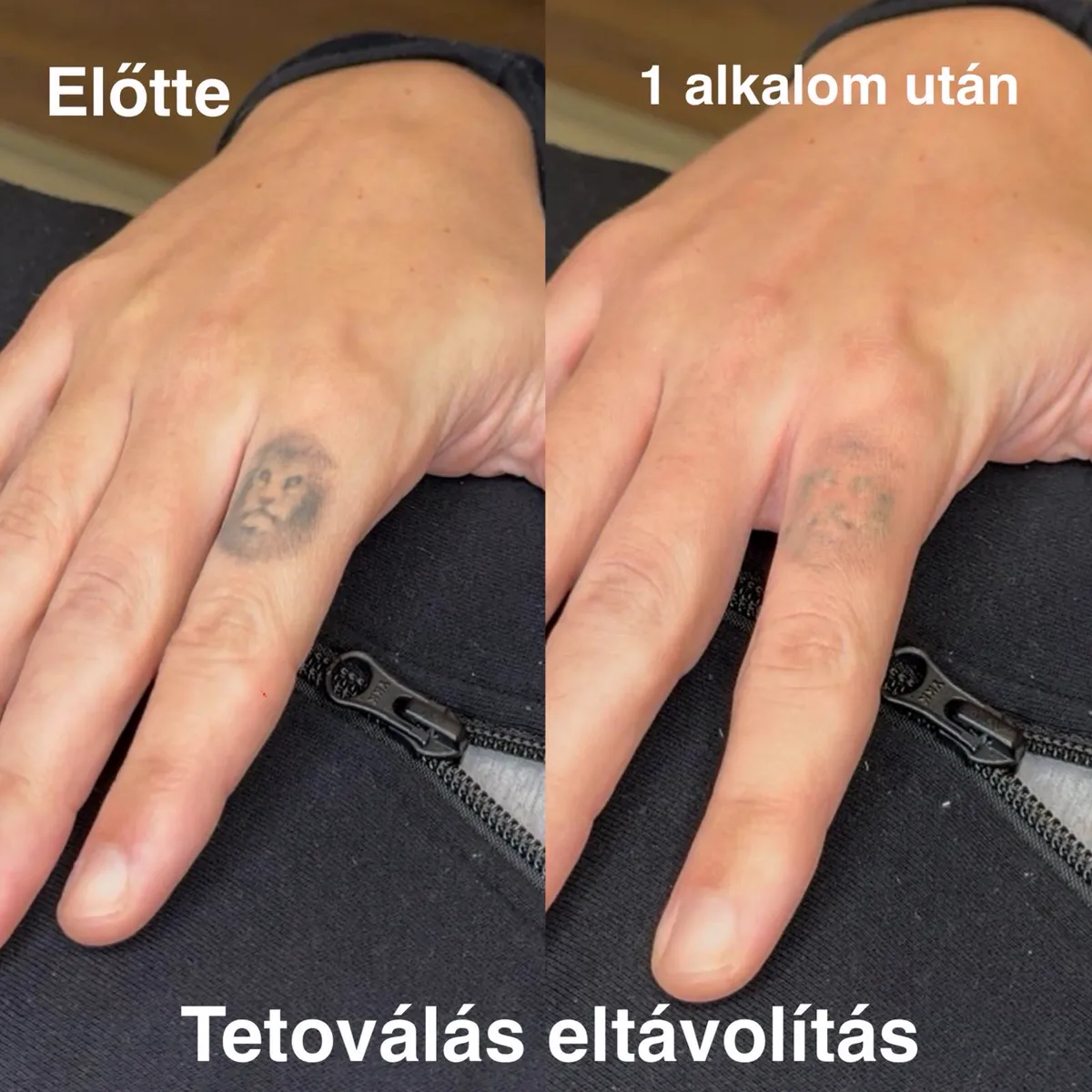 Referencia 7: előtte és utána