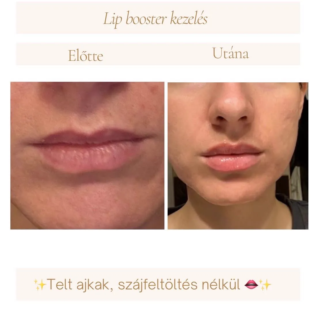 Referencia 8: előtte és utána